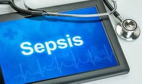 Sepsis early warning technology could save thousands of lives Sepsis early warning technology could save thousands of lives